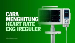 Cara Menghitung Heart Rate Ekg Ireguler